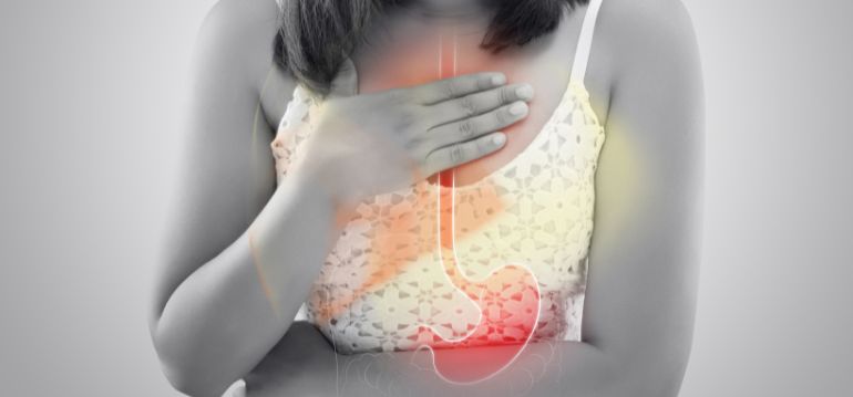 Doença do Refluxo Gastro-esofágico (DRGE)
